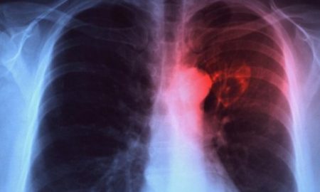 الصورة توضيحية من الاتترنت